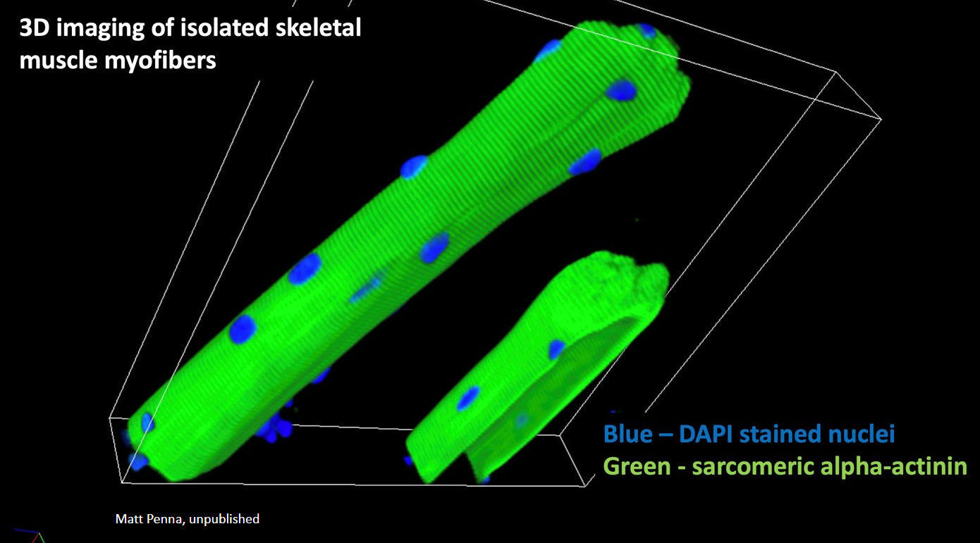 3D imaging of isolated skeletal muscle myofibers.