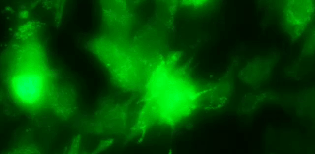 Cardiomyocyte reprogramming