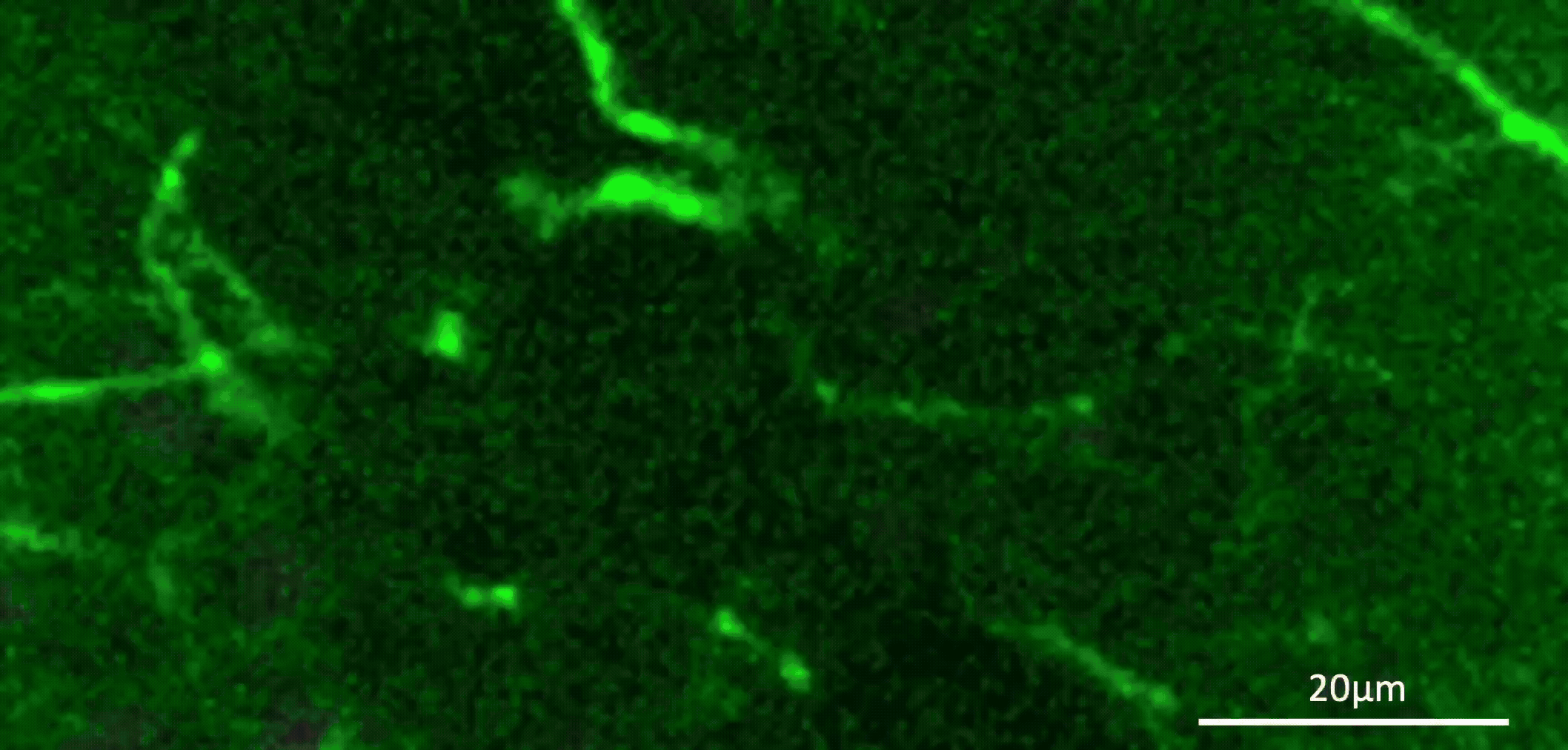 simultaneous imaging of acetylcholine sensors and cholinergic axon activity in vivo