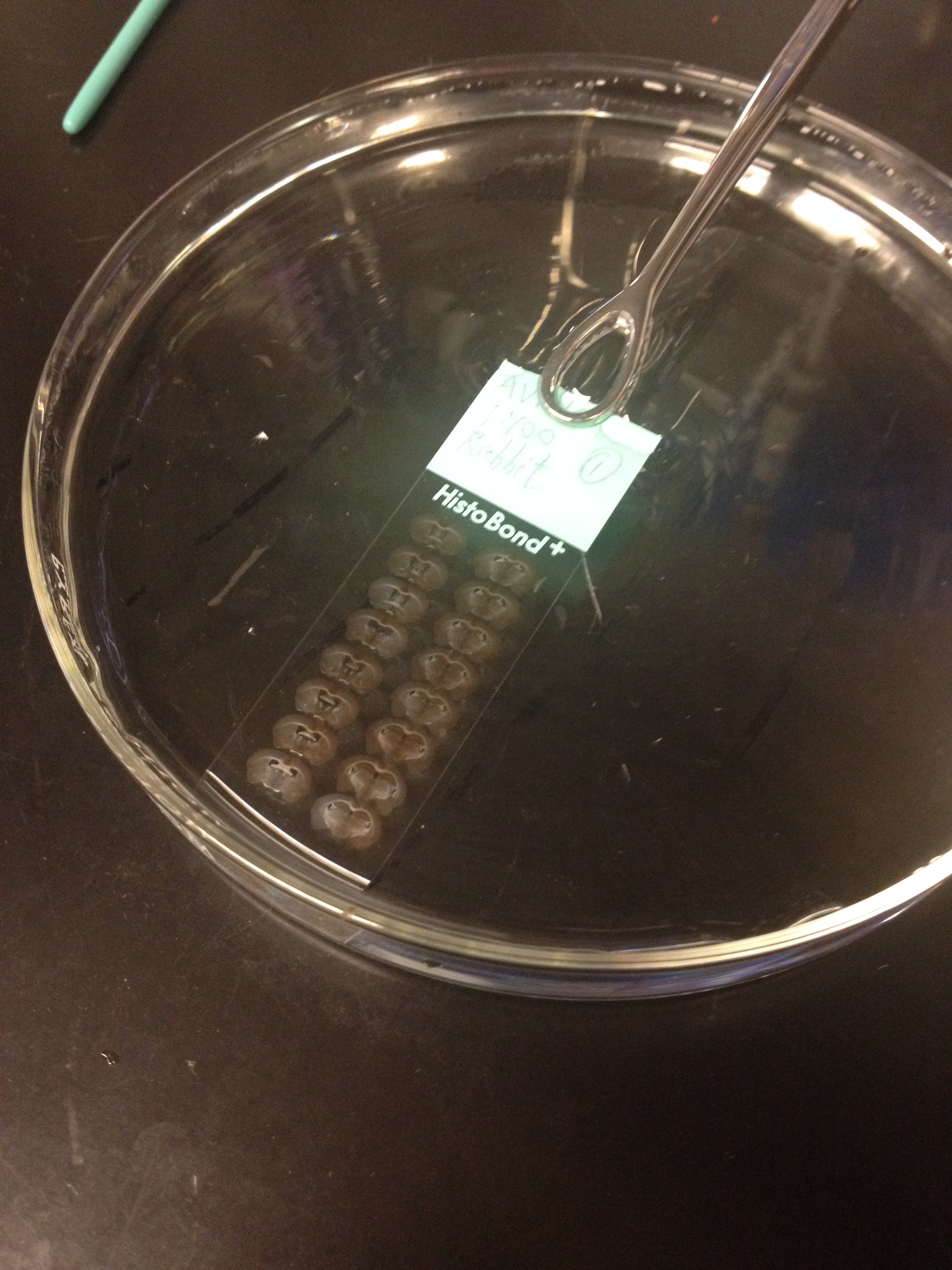 Immunostaining of coronal brain sections