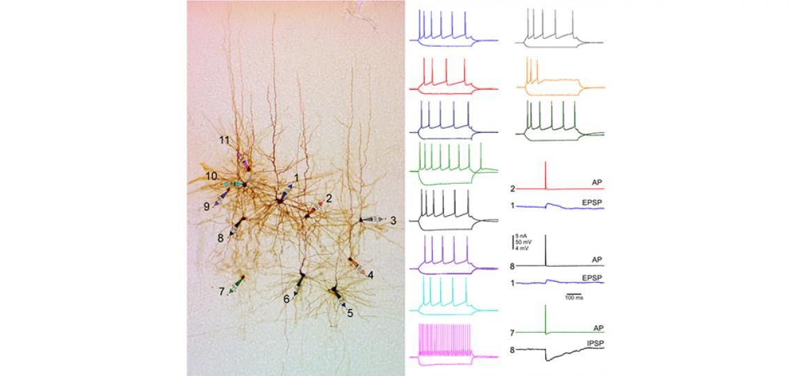 Simultaneous 11-cell Patch-clamp Recordings