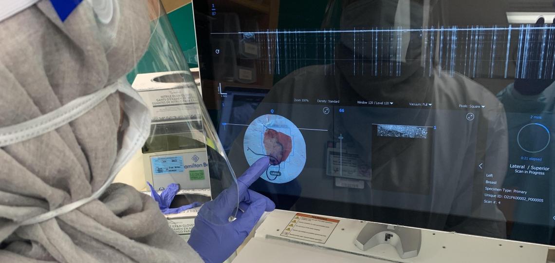 Researchers examine breast tissue removed during a lumpectomy using the OTIS ImgAssist technology. 
