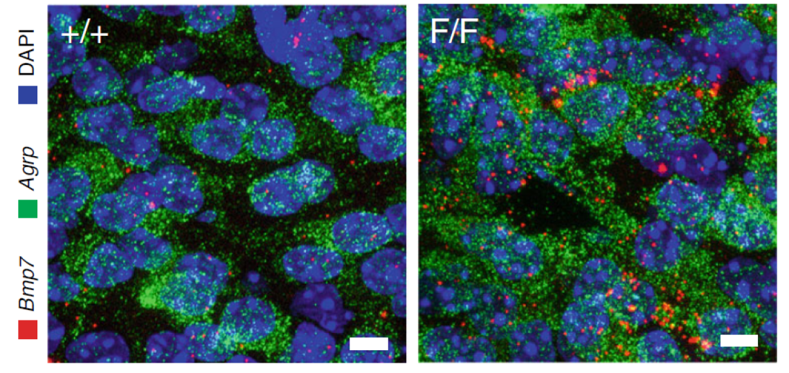 Stained brain cells using Leica SME microscope