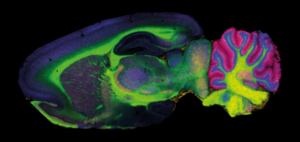 Fluorescent cross-section of a mouse brain showing colorful neural regions.