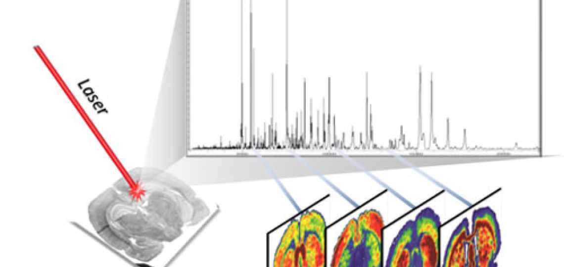 This image is a scientific diagram showing how a laser is used to analyze a brain slice. 
