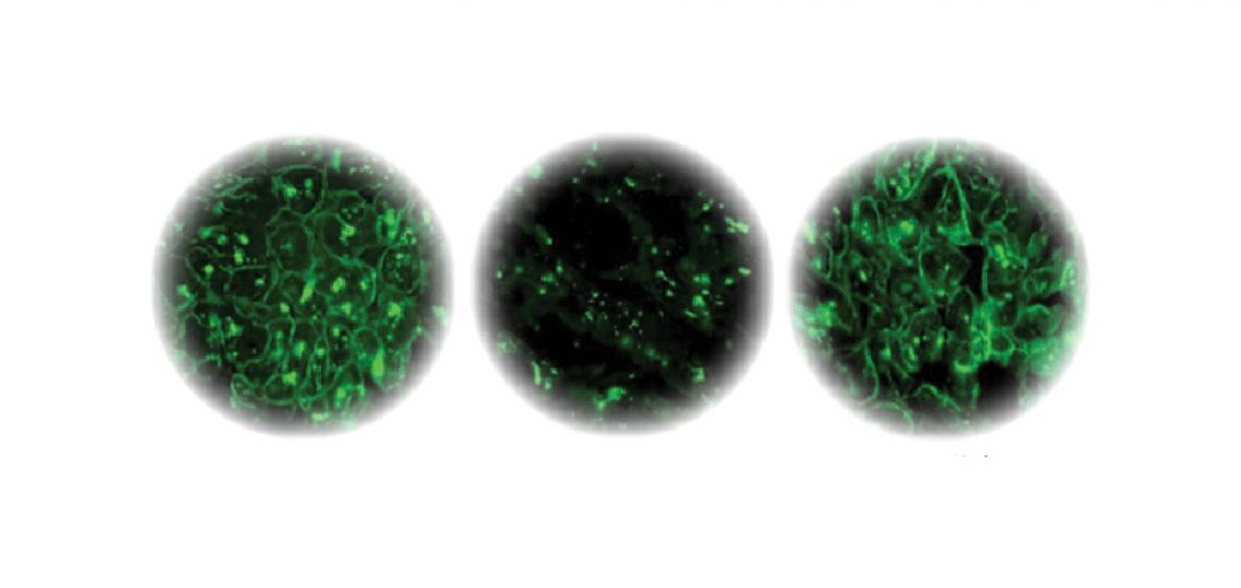Left: Dystrophin staining of normal heart muscle. Center: Dystrophin staining of failing heart muscle. Right: Dystrophin staining of failing heart muscle after LVAD implantation.