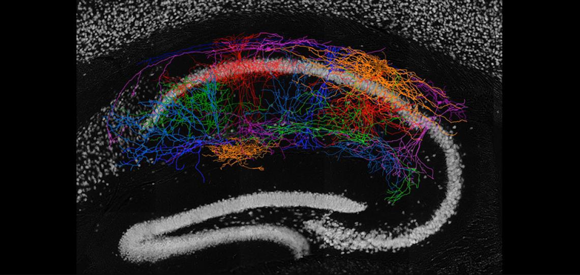 Morphological reconstruction of the CA1 neurons in the hippocampus revealed the high diversity of interneuron types in mouse hippocampus CA1 area.