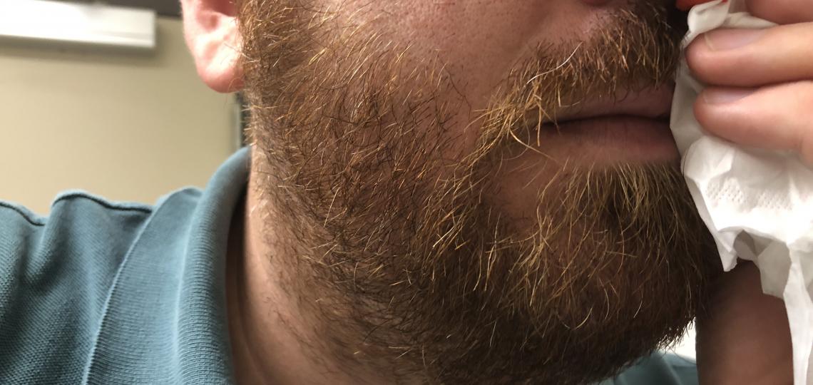 While everyone has their own idea of how to remedy the occasional bloody nose, Baylor College of Medicine’s Dr. Eddie Liou breaks down what is really happening to cause the bleed and how to manage it.