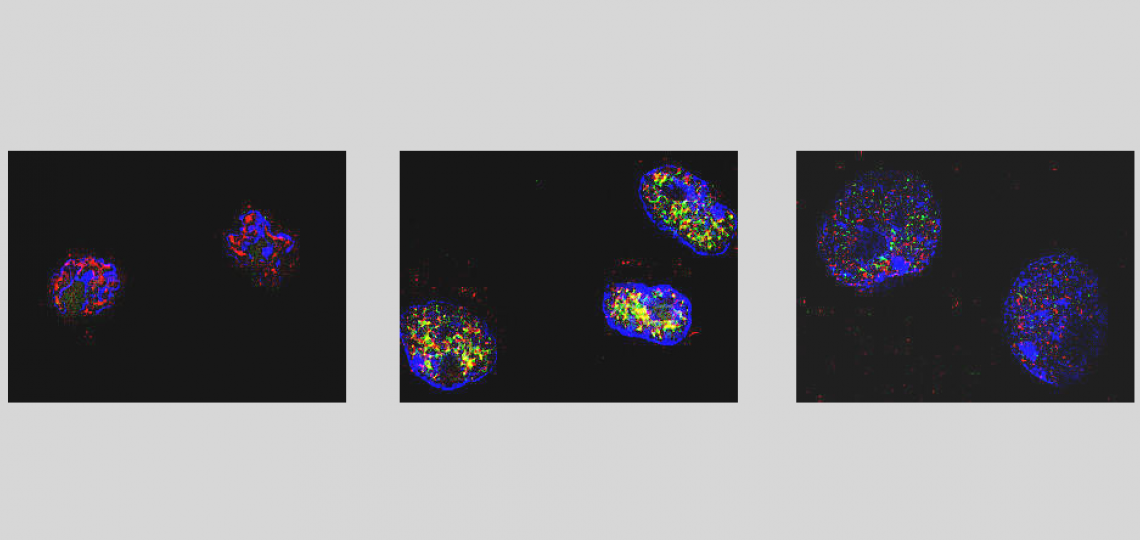 The cyclin T1 subunit of the HIV Tat cofactor TAK/P-TEFb is transiently induced during macrophage differentiation.
