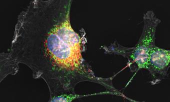 Zika virus's non-structural protein NS1 (red) and mitochondria (green) travel through the tunneling nanotube (TNT, gray) from infected to uninfected placental cells. 