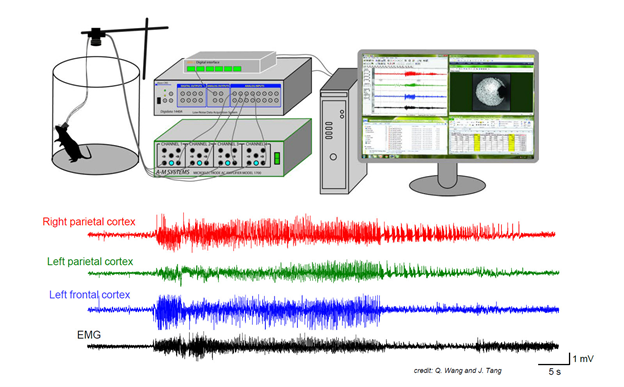 Photo of Video-EEG-recordings in freely moving mice