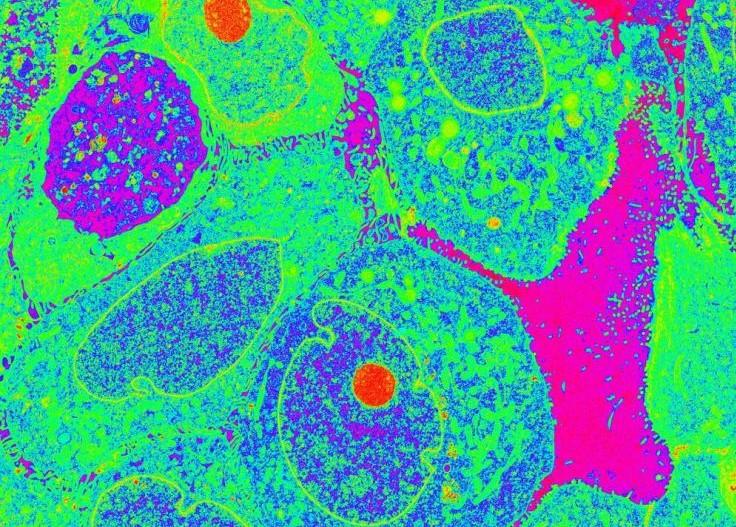 r19-58a 1 mito-01 cropped