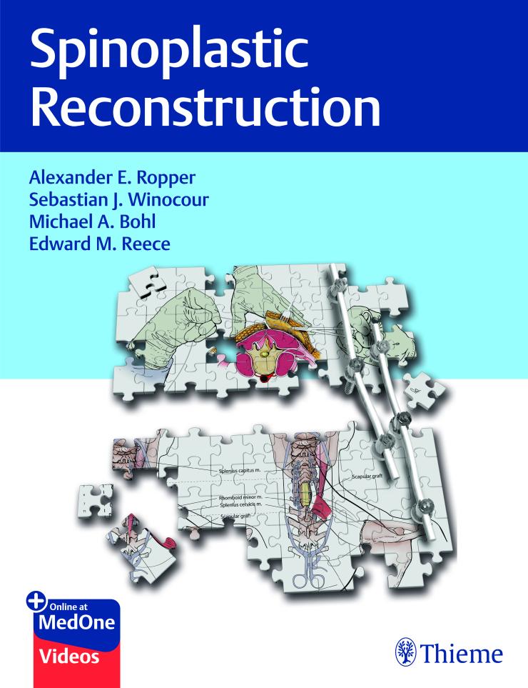 Spino-Plastic Reconstruction - Ropper, Winocour et al.
