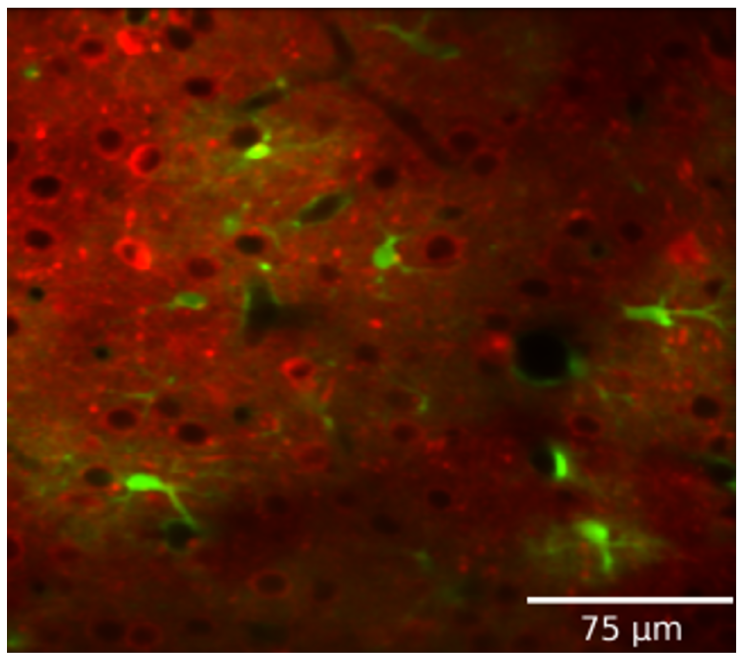 illustration showing local changes in neural activity and global neuromodulatory signals