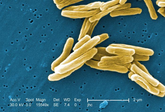 Scanning electron micrograph of a number of Gram-positive Mycobacterium tuberculosis bacteria. Magnification, 15549x.