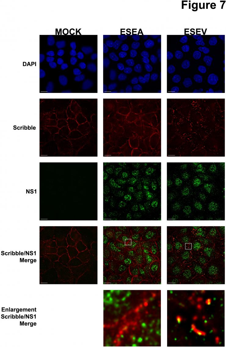 Disruption of Scribble (red) localization by influenza NS1 (gren). Left: mutant NS1. Right: wild-type NS1