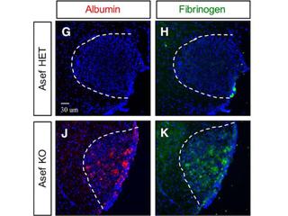 Temporal profiling of astrocyte precursors reveals parallel roles for Asef during development and after injury