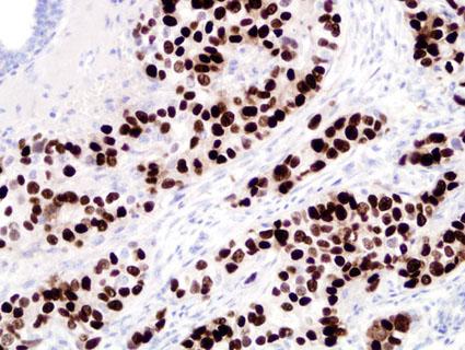 PR by IHC Stained Slide