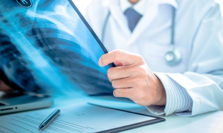 A doctor in a white coat with a chest X-ray in his hands.