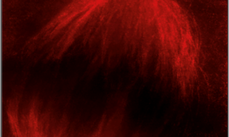 Super-resolution imaging of a cell undergoing mitosis.