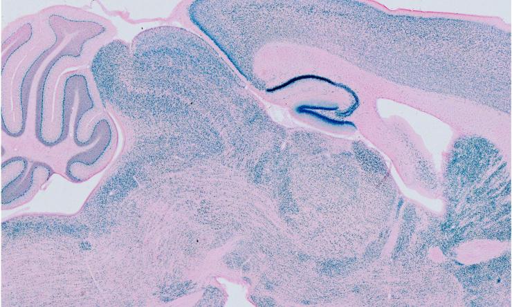 Microscopy image of slice of brain.