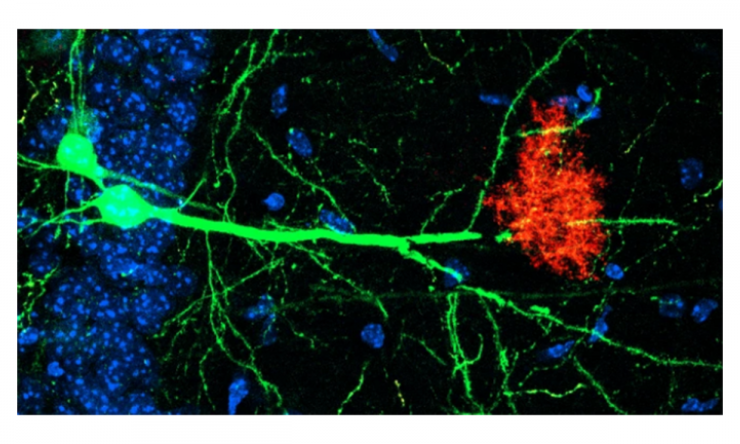 Image depicting Neurons (green) and astrocytes (red) work together to regulate storage and retrieval of memories