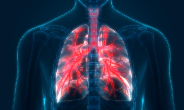 An illustration of the lungs.